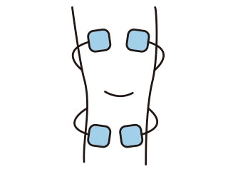 General TENS electrode pad placement around the knee
