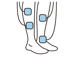 General TENS electrode pad placement on the lower legs