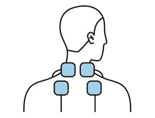 General TENS electrode pad placement around the back of the neck and upper shoulder area