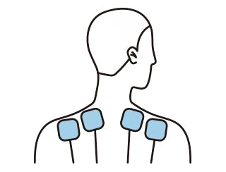 General TENS electrode pad placement across both shoulders